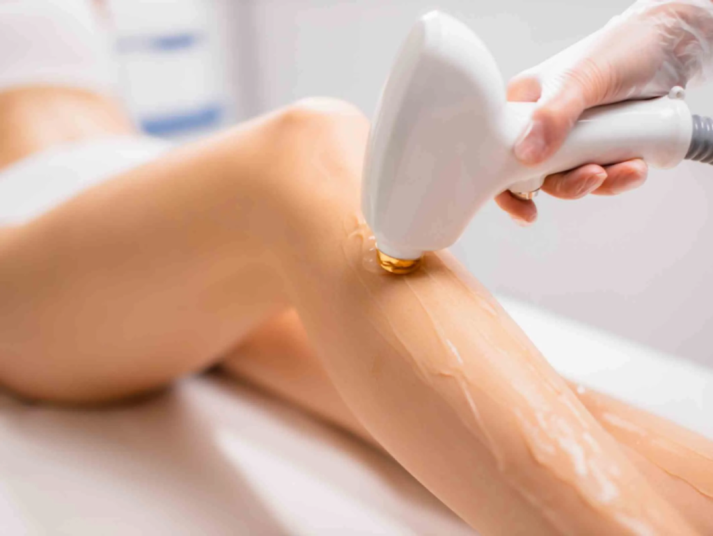 Laser Hair Removal